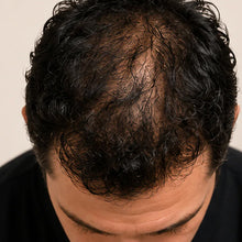 Before - Estoy sorprendido